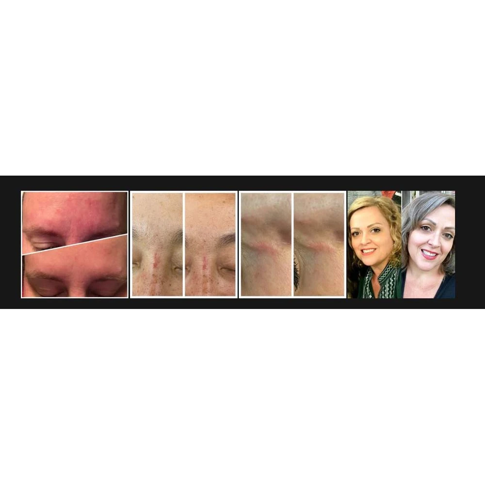 Orblife Facial Light And Therapy Wrap 10 Orblife Facial Light And Therapy Wrap - Image 8